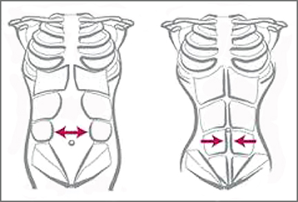 PostPregnancyRehab.com